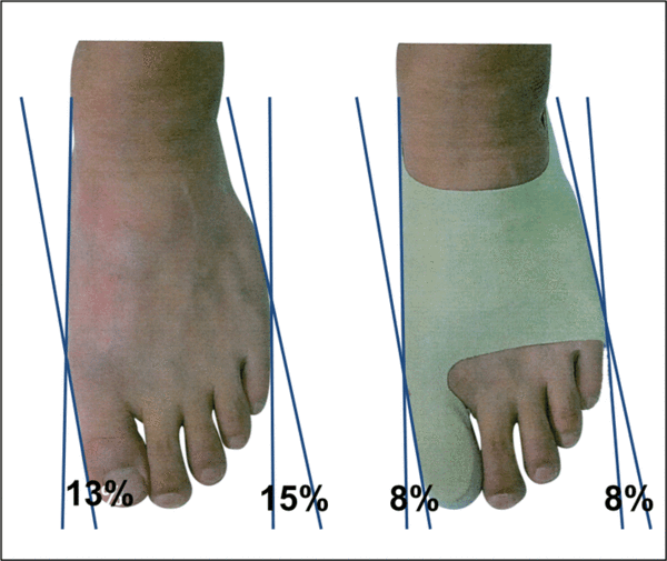 Gel Protection Sleeve Silicone Toes Separator