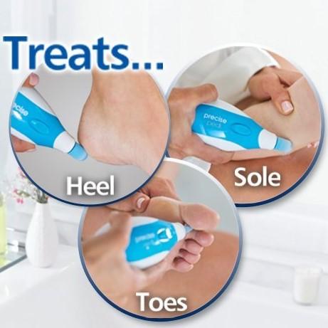 Electric Callus Remover Foot File Precise Pedi