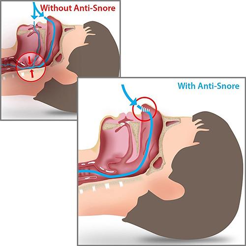 Snore Stopper Effectively Stop